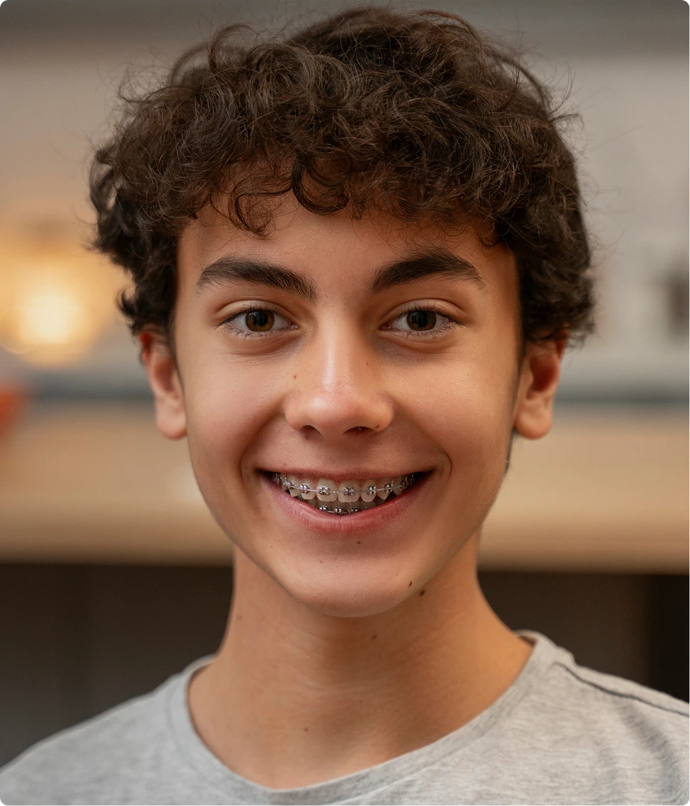 Recovery After Impacted Tooth Exposure Banner
