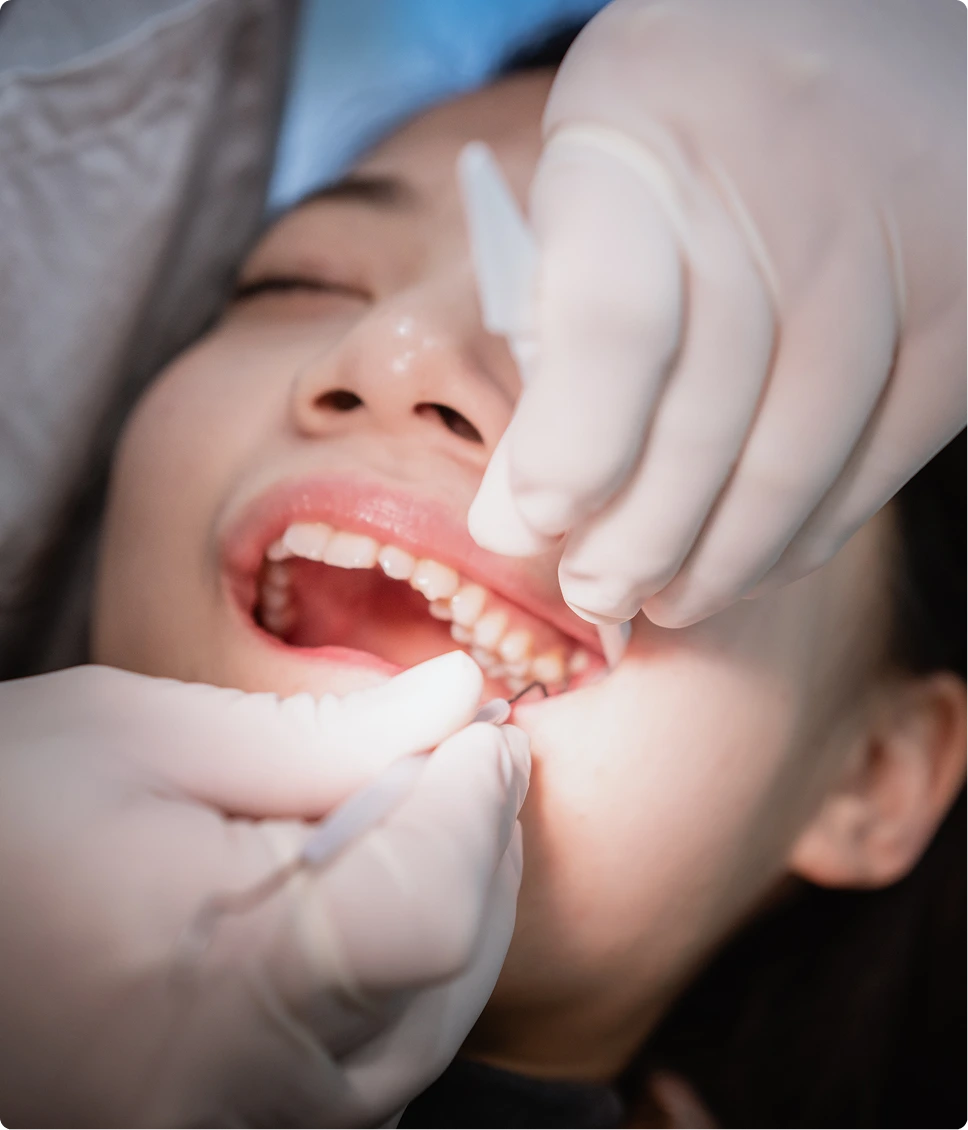 What Are Impacted Teeth? Banner