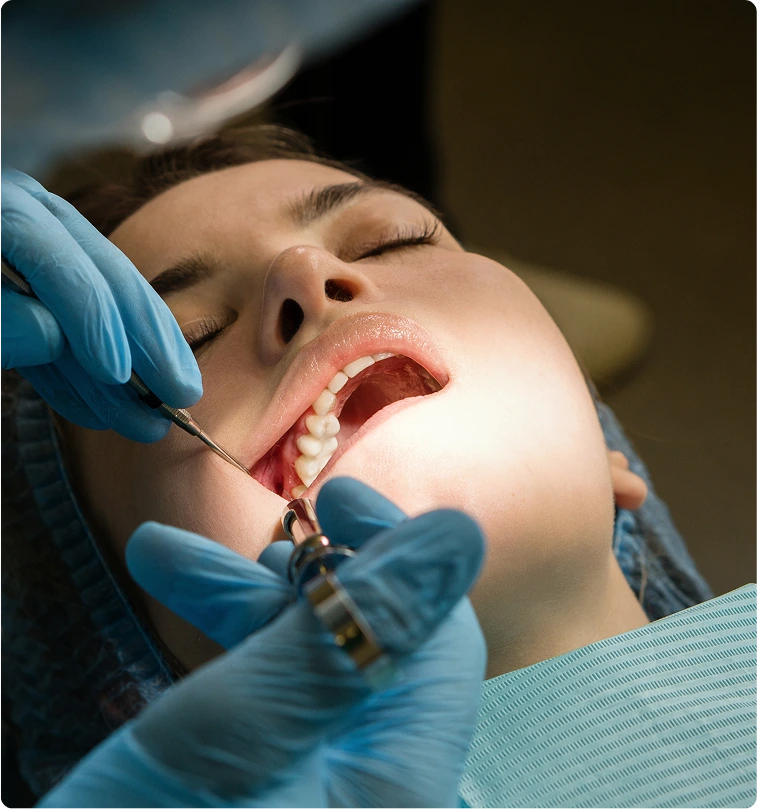 How Are Impacted Wisdom Teeth Removed Denver, CO Banner