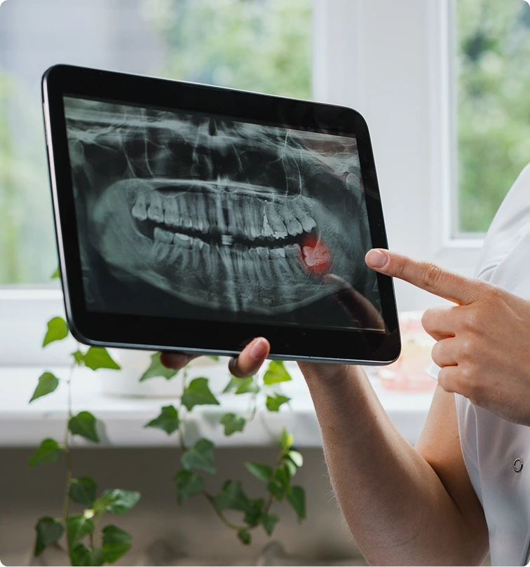 Why Are Impacted Wisdom Teeth Dangerous in Denver, CO Banner