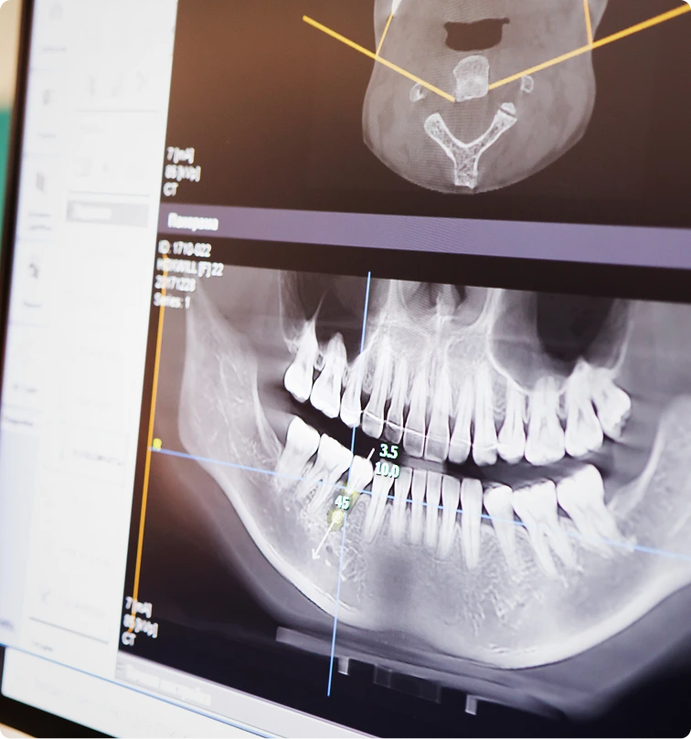 Your Initial Consultation in Denver, CO Banner